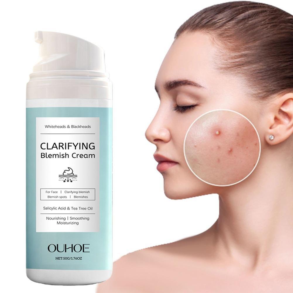 Salicylzuur Acne Verwijderende - Salicylic Acid Blackhead Remover recensie en prijs