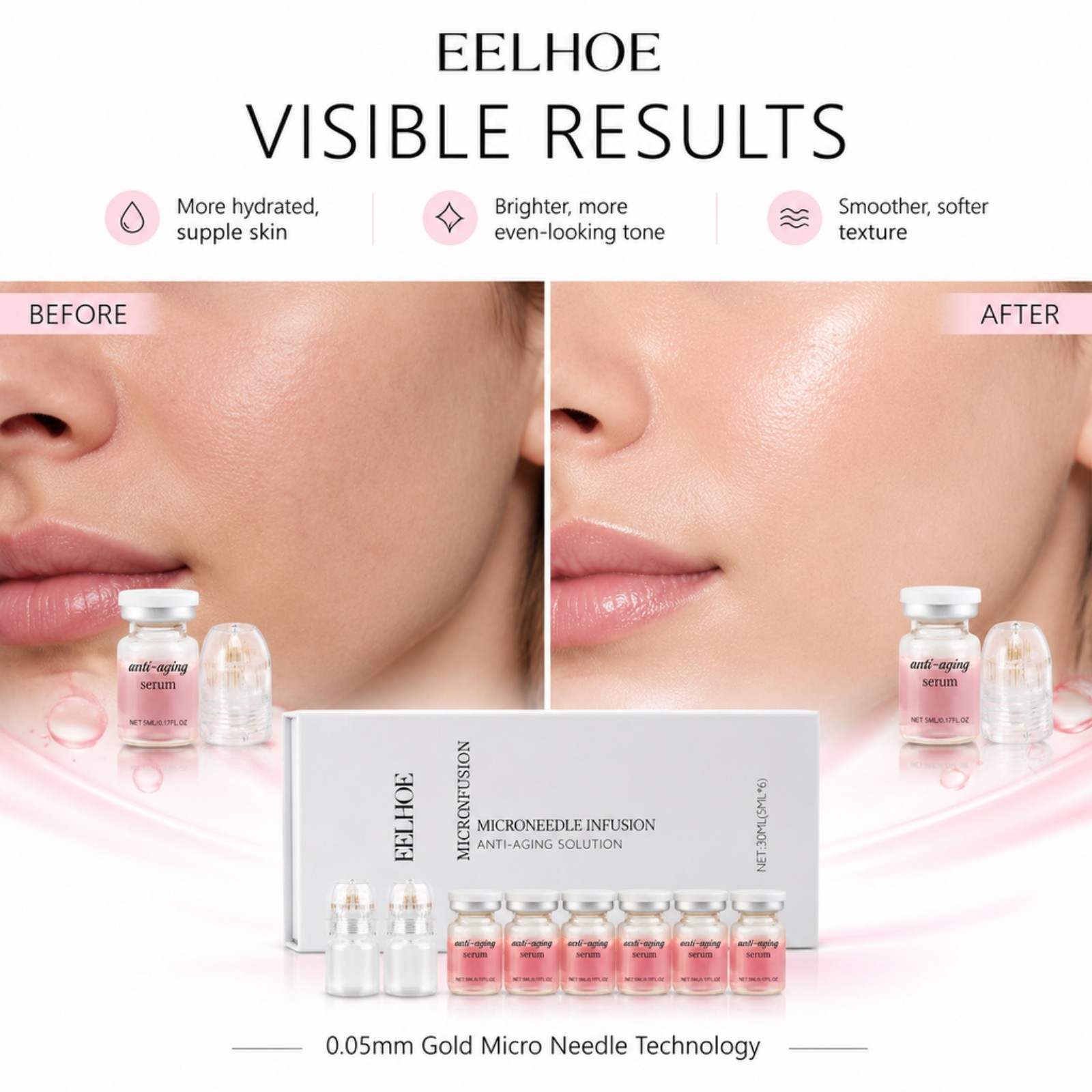 0,2 mm Microneedle Serum Kit 6 - Hyaluronic Acid Facial Serum recensie en prijs